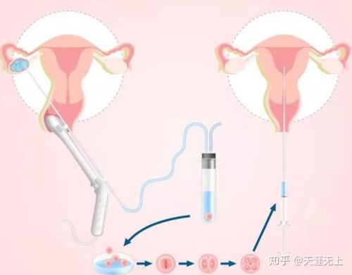 正规供卵试管机构